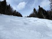 The mogul slopes challenge even the experts