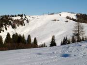 Downhill Pre dai Corf