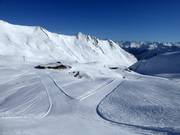 Runs at Masner (Serfaus)