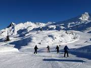 Easy Riedkopf Bypass