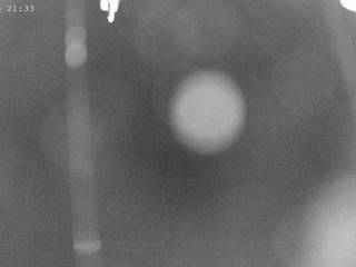 St. Gréé/Black Slope